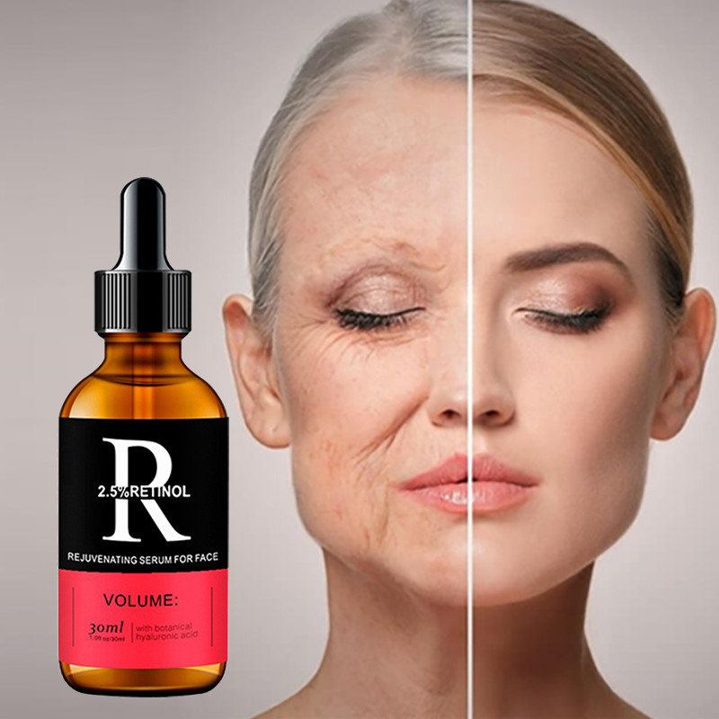 Azelaic Acid Serum - Suero Facial para el cuidado de