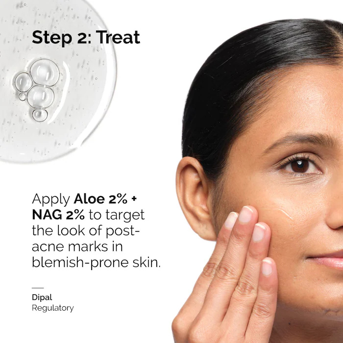 Aloe 2% + NAG 2% Solución Suer - Aha Bha Exfoliant reseña y precio
