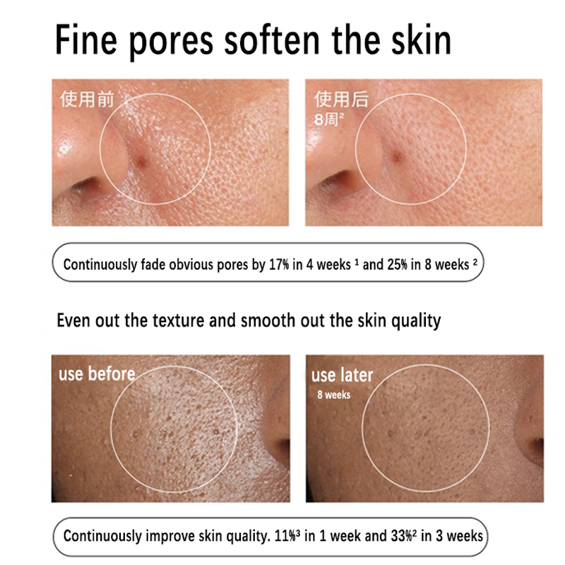 Suero con Aloe 2% + NAG 2% 30m - Azelaic Acid Serum reseña y precio