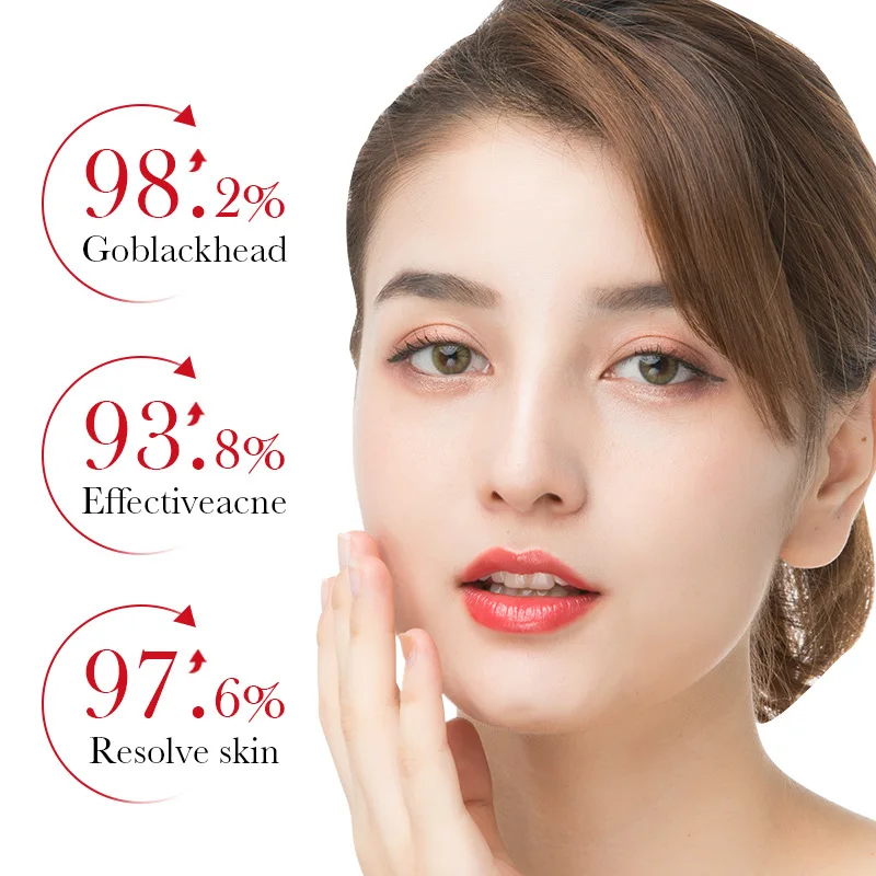BIOAQUA ácido salicílico elimi - Azelaic Acid Serum reseña y precio
