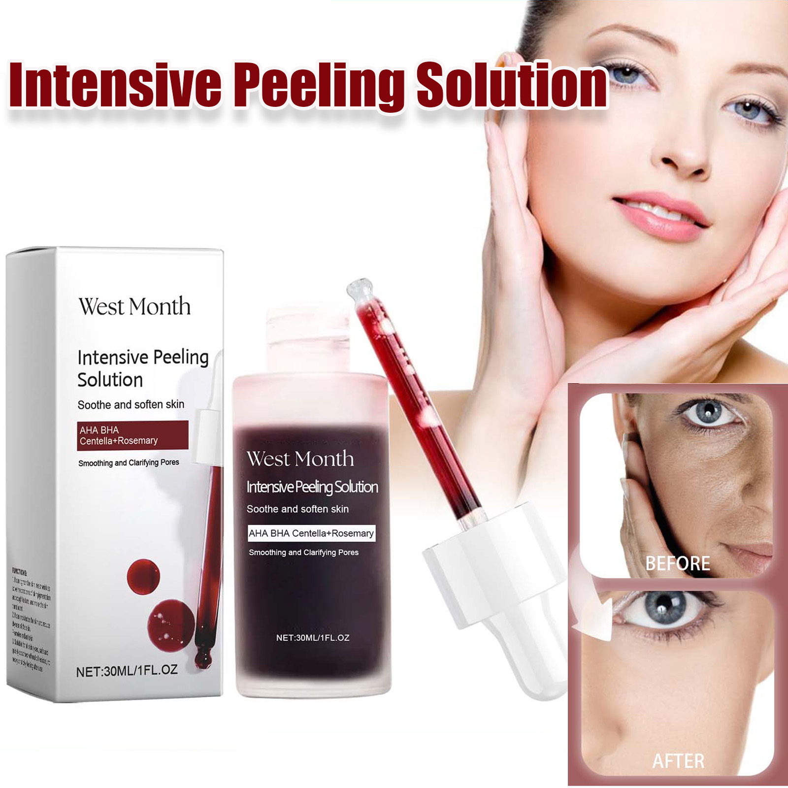 Suero Facial exfoliante antiac - Azelaic Acid Serum reseña y precio